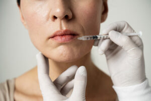 Liposuction
