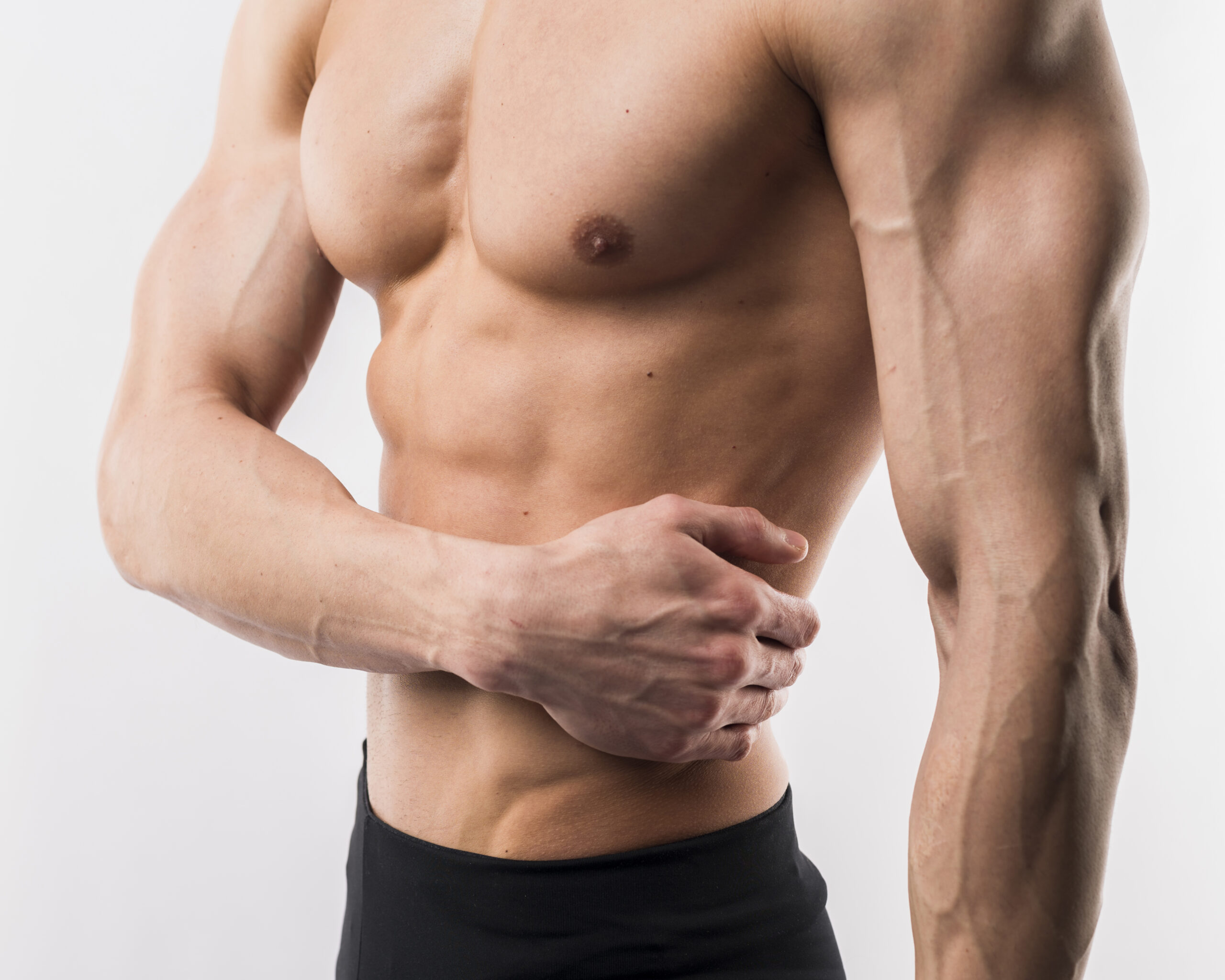 Gynecomastia