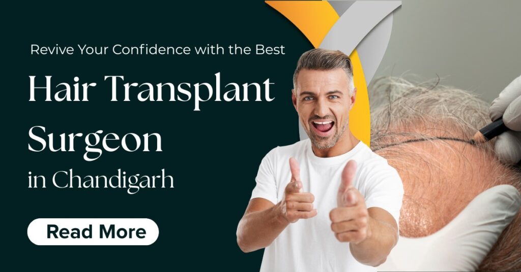 Best Hair Transplant Surgeon in Chandigarh