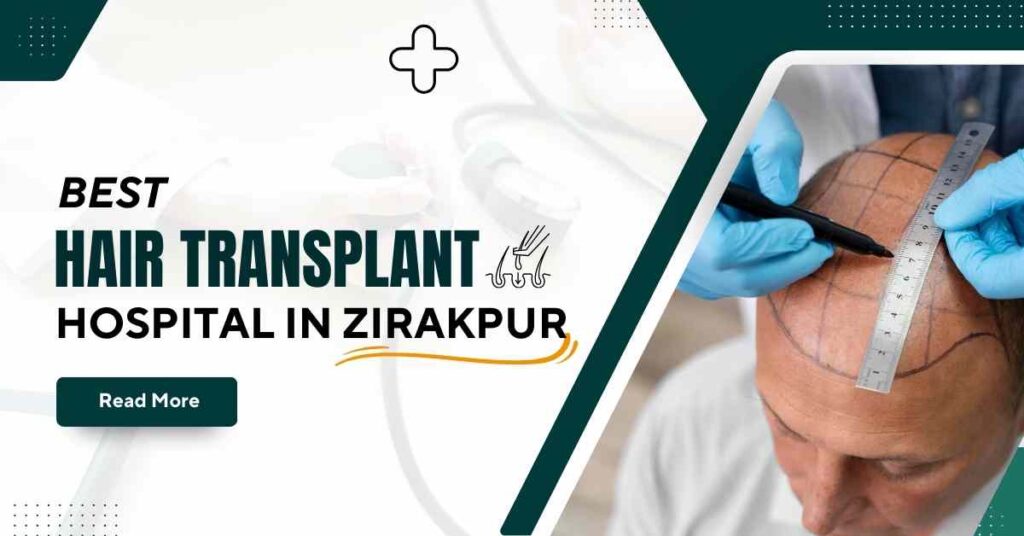 Best Hair Transplant Hospital in Zirakpur