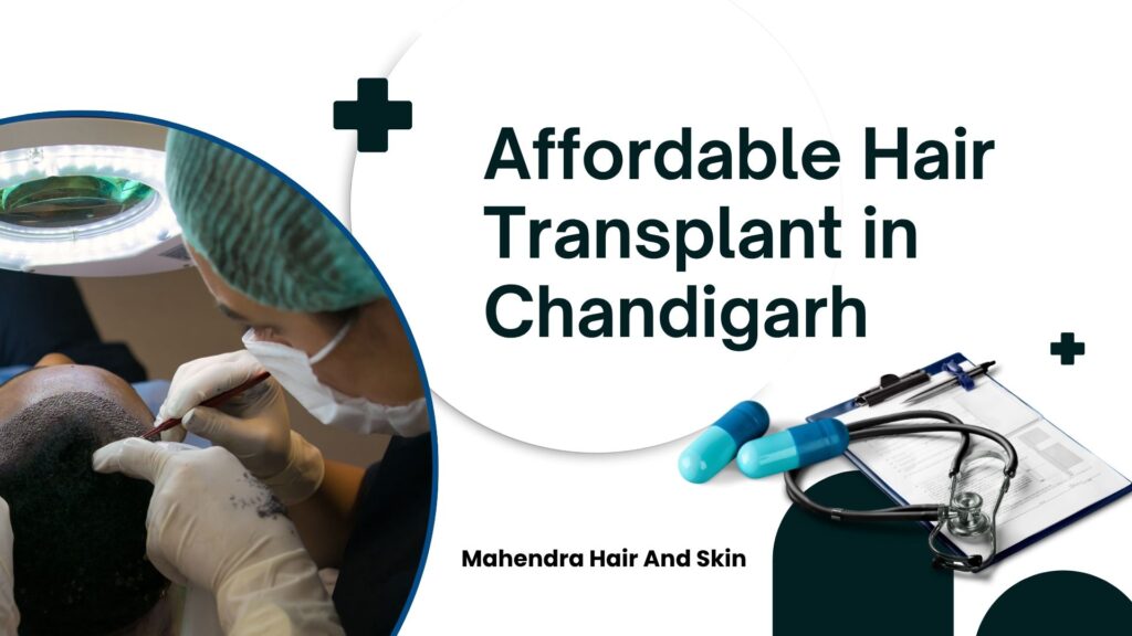 affordable hair transplant in Chandigarh