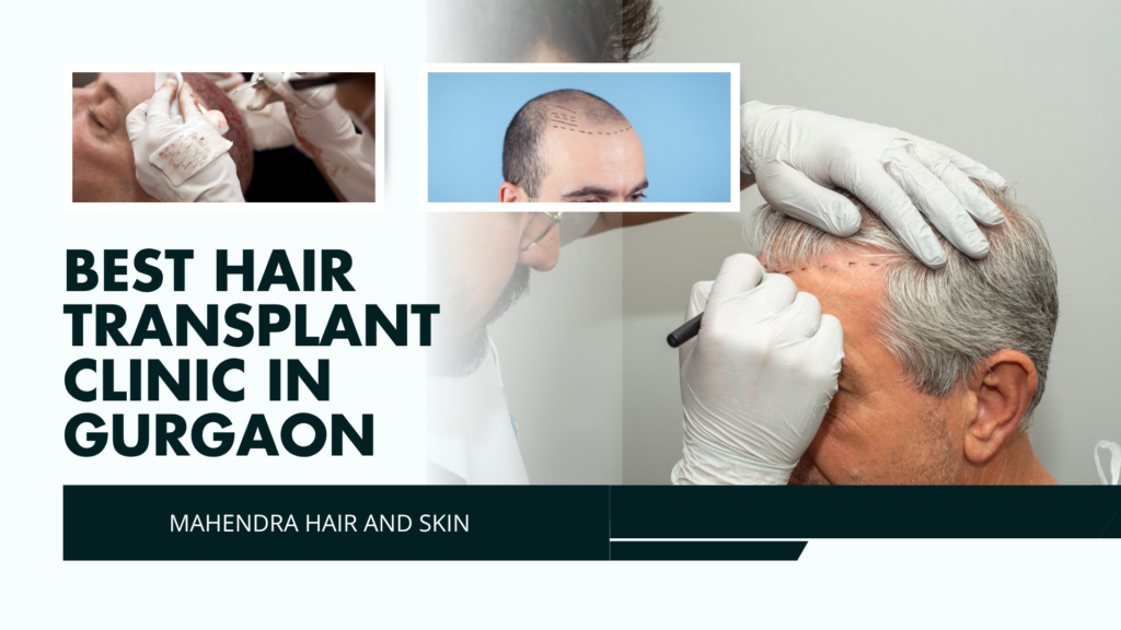 Best Hair Transplant Clinic in Gurgaon