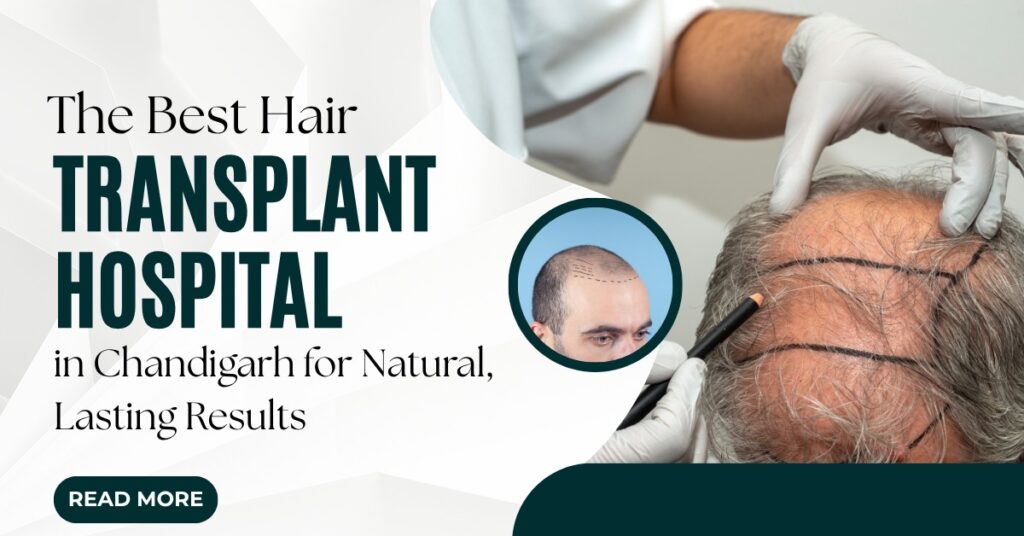 Best Hair Transplant Hospital in Chandigarh