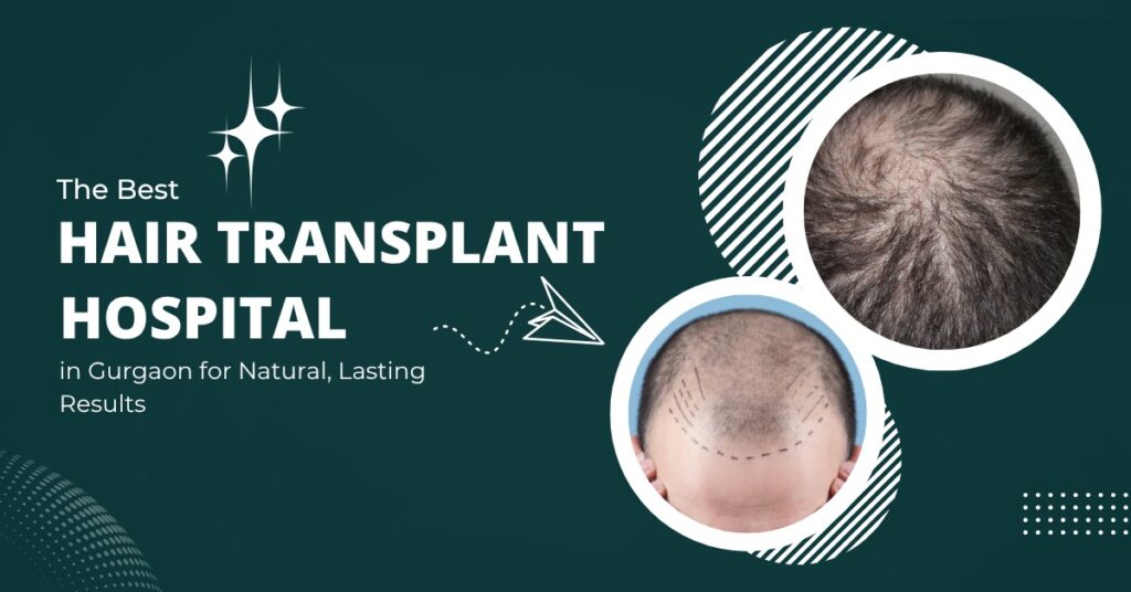 Best Hair Transplant Hospital in Gurgaon