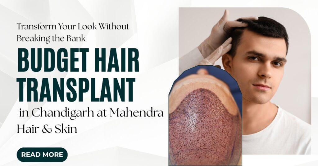 Budget Hair Transplant in Chandigarh