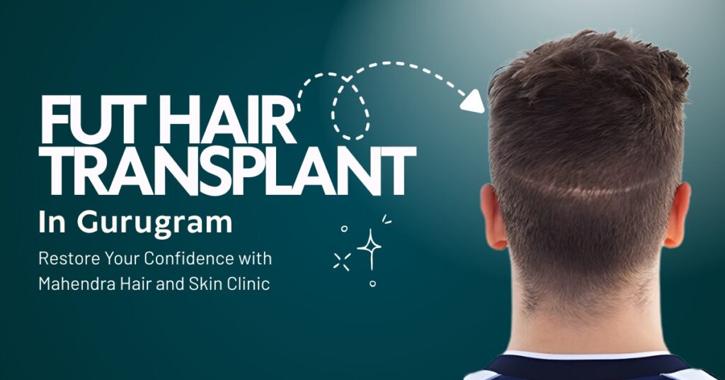 FUE Hair Transplant in Gurugram