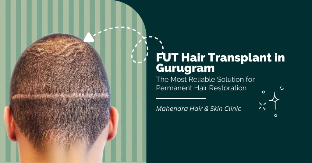 FUT Hair Transplant in Gurugram