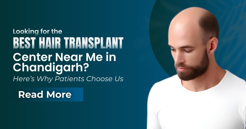 Best Hair Transplant Center Near Me (Chandigarh)