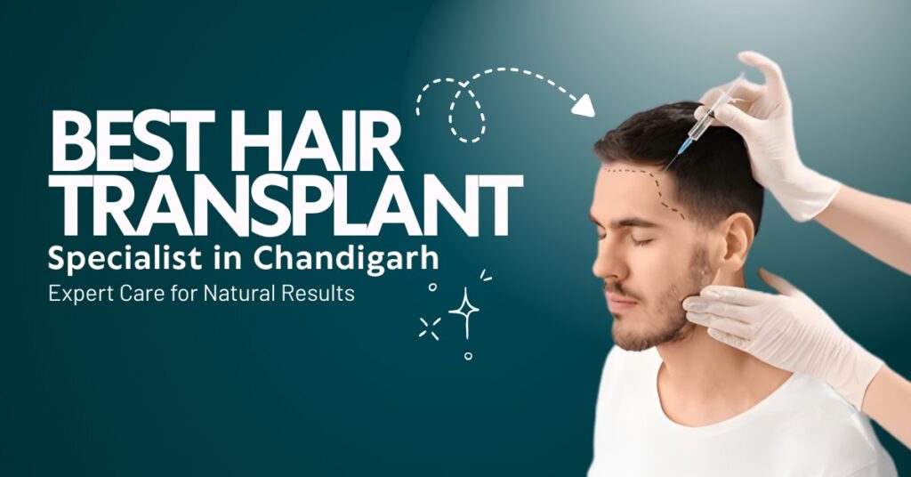 Best Hair Transplant Specialist in Chandigarh