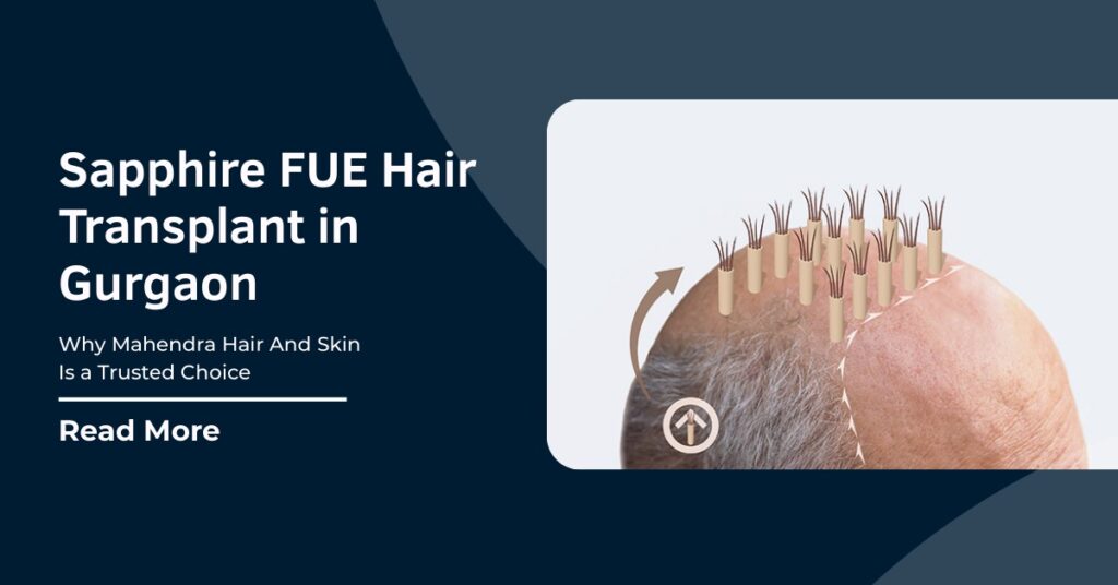 Sapphire FUE Hair Transplant in Gurgaon
