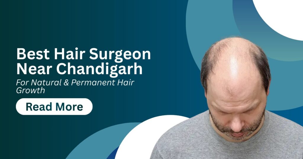 Best Hair Surgeon Near Chandigarh