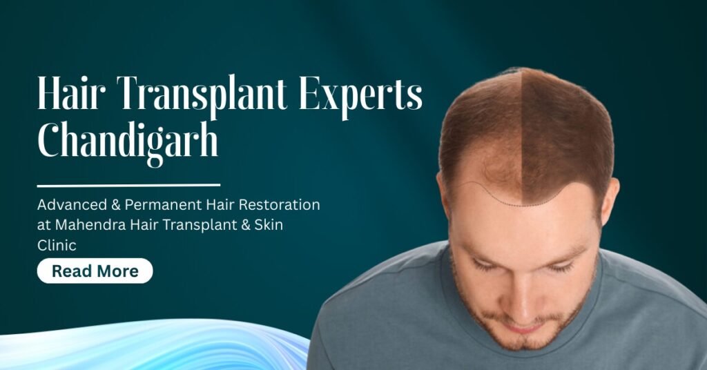 Hair Transplant Experts Chandigarh